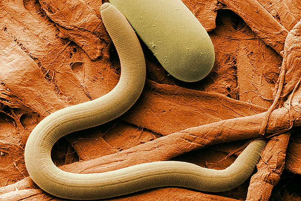 Повышение содержания некоторых белков замедляет старение миниатюрных круглых червей — нематод