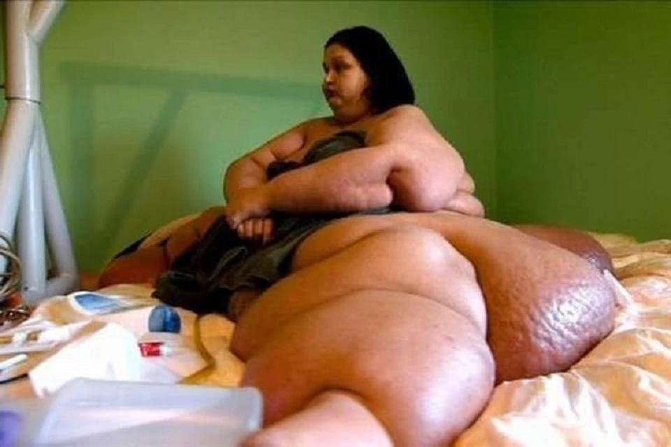 Раньше Майра Росалес весила 499 килограммов. Фото: Майра Росалес/Facebook