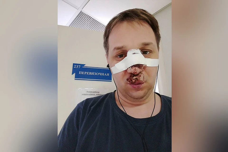 Андрей Пожидаев получил серьезные травмы и сейчас находится в больнице