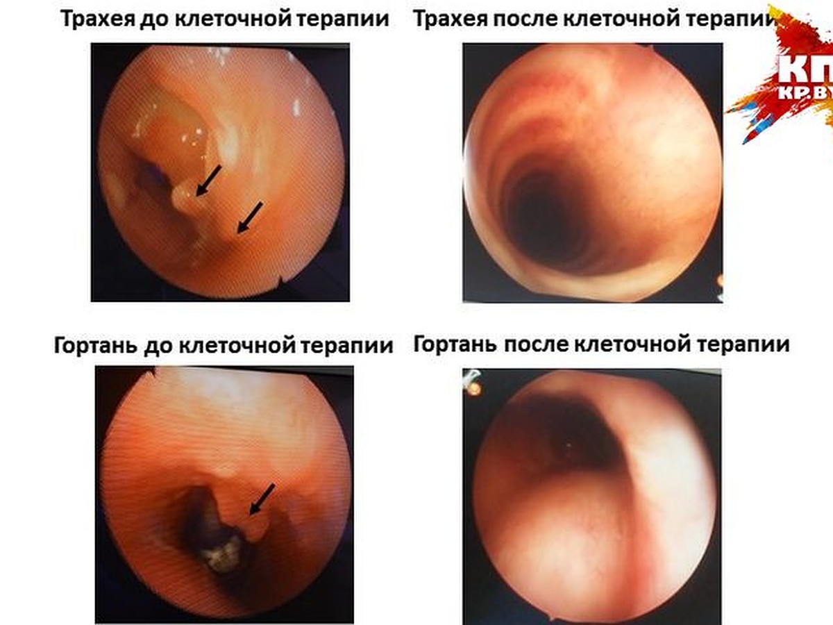 Болезни трахеи, ринит, дерматит: белорусские ученые разрабатывают метод  избавления от многих воспалительных заболеваний - KP.RU