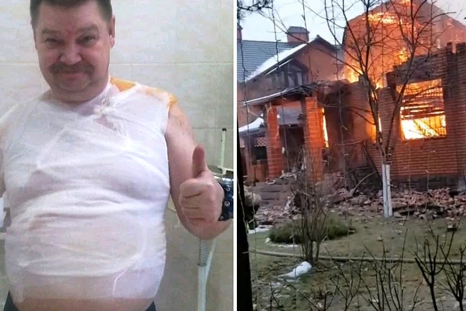 Сам юморист в результате пожара обжег спину, а его дом сгорел.