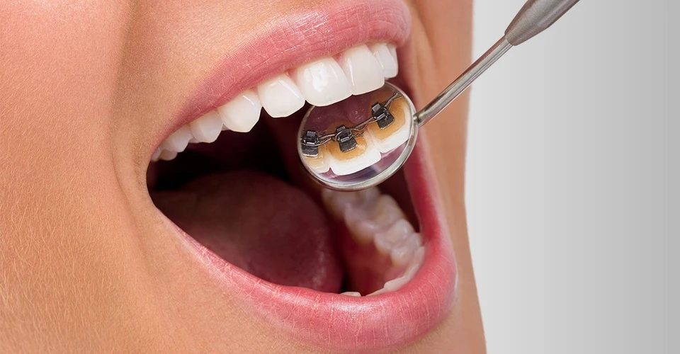 Зубы — ваш главный аксессуар, показатель социального статуса