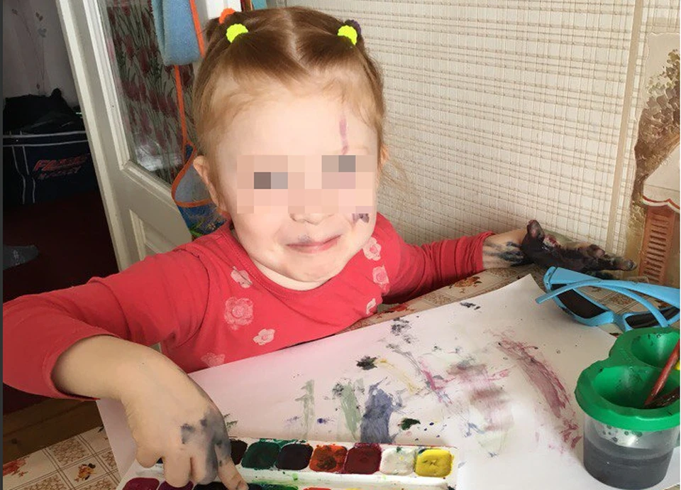 Амина сразу же после удара была без сознания.