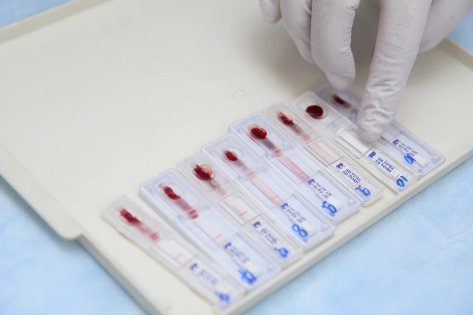 Кровь на вич 1 2. Экспресс-тест на ВИЧ-1/2. Тест-полоски на ВИЧ ISCREEN-HIV (1&2). Экспресс тест на ВИЧ кровь. Экспресс тест на ВИЧ кровь из пальца.