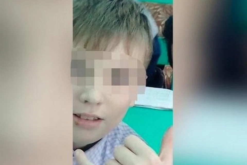 В Красноярском крае школьнику на уроке выбили глаз молотком.Фото: соцсети