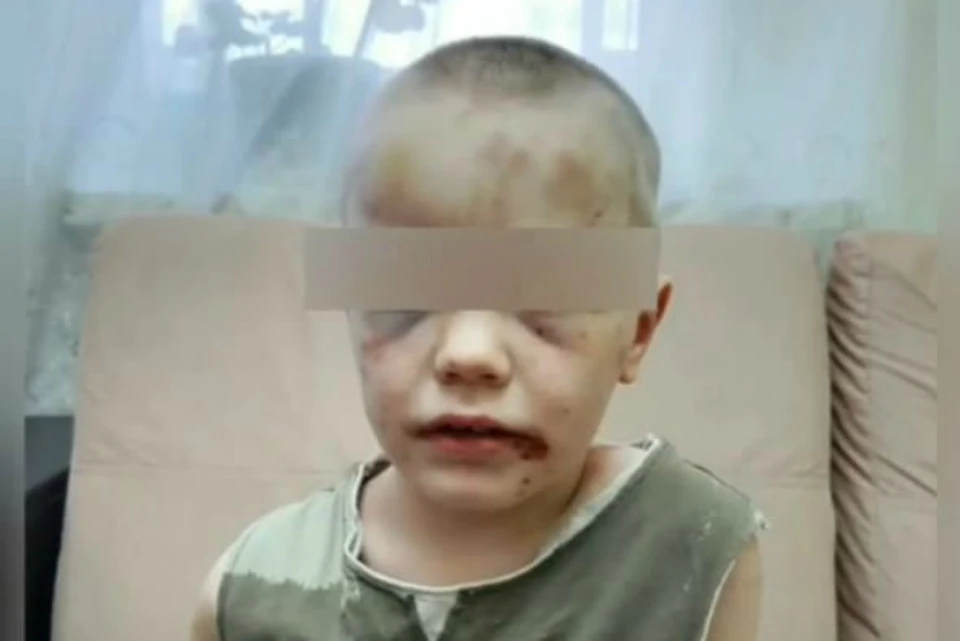 С сотрясением мозга мальчик находится в больнице. Фото: "ЧП Новороссийск"