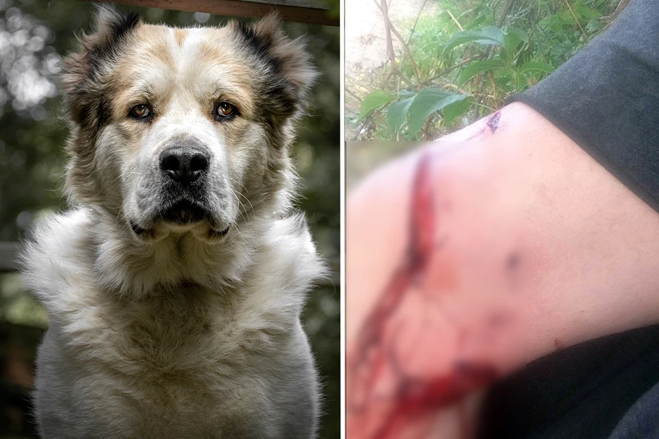 Алексей написал заявление в полицию. Но напавшую на мужчину собаку и её хозяев пока так и не нашли
