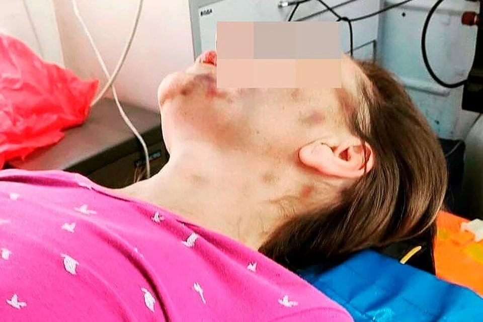 Жертвой домашнего насилия стала учительница английского языка из села в Самарской области