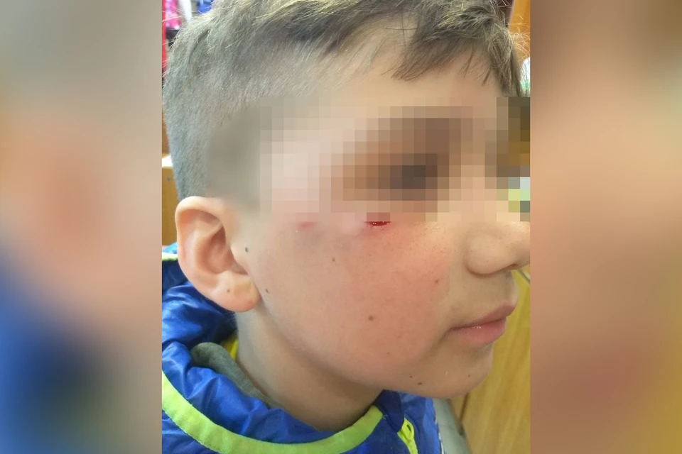 Мяальчик подошел к собаке, чтобы погладить ее, но животное испугалось и напало.