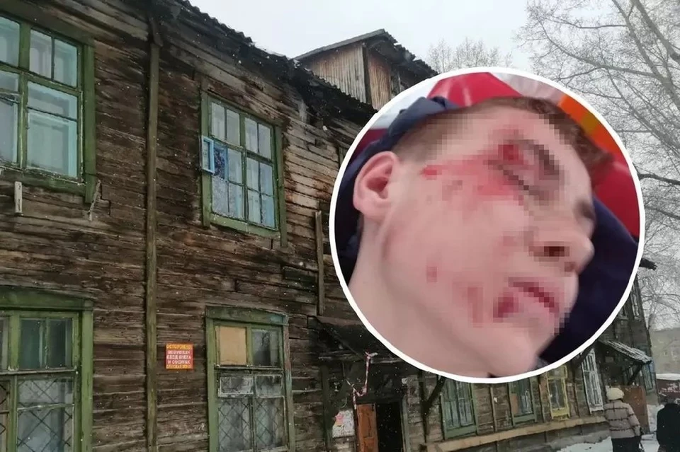 Глыба рухнула на парня с крыши дома. Фото: Анна ПАШАГИНА/предоставлено Екатериной.