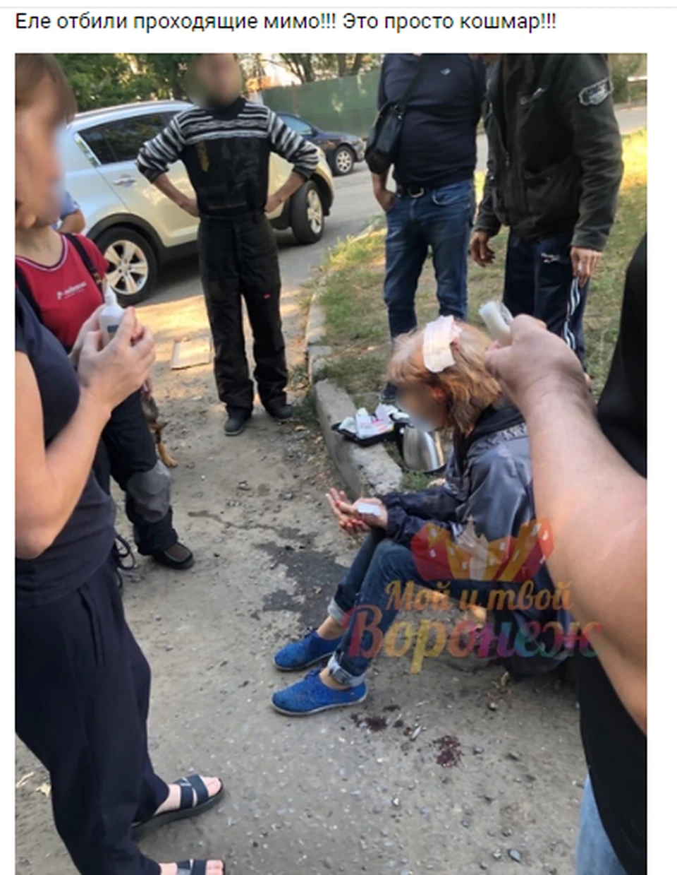 Женщина после нападения озверевших псов.