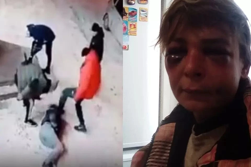 Женщина получила несколько десятков ударов по голове. Фото: личный архив.