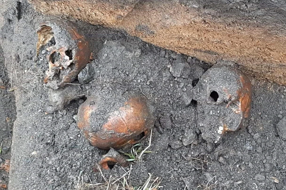 Кости и черепа выкопали рядом с жилым домом. Фото: Валентина Волкова