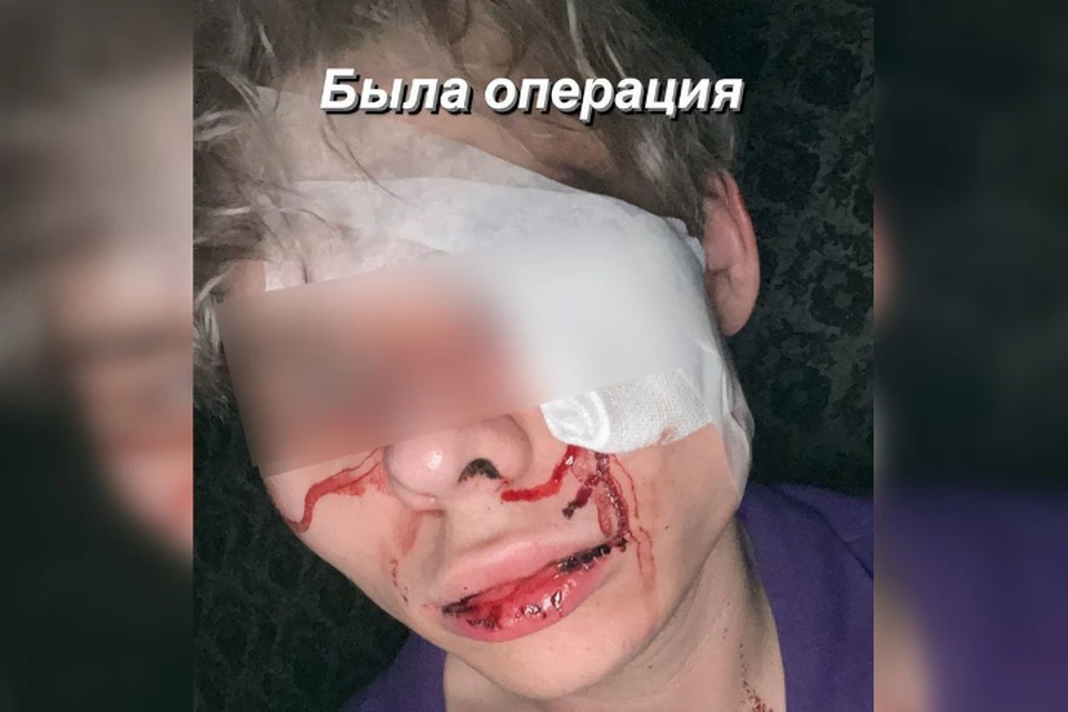 Кассир попросил надеть маску повыше, клиент отказался