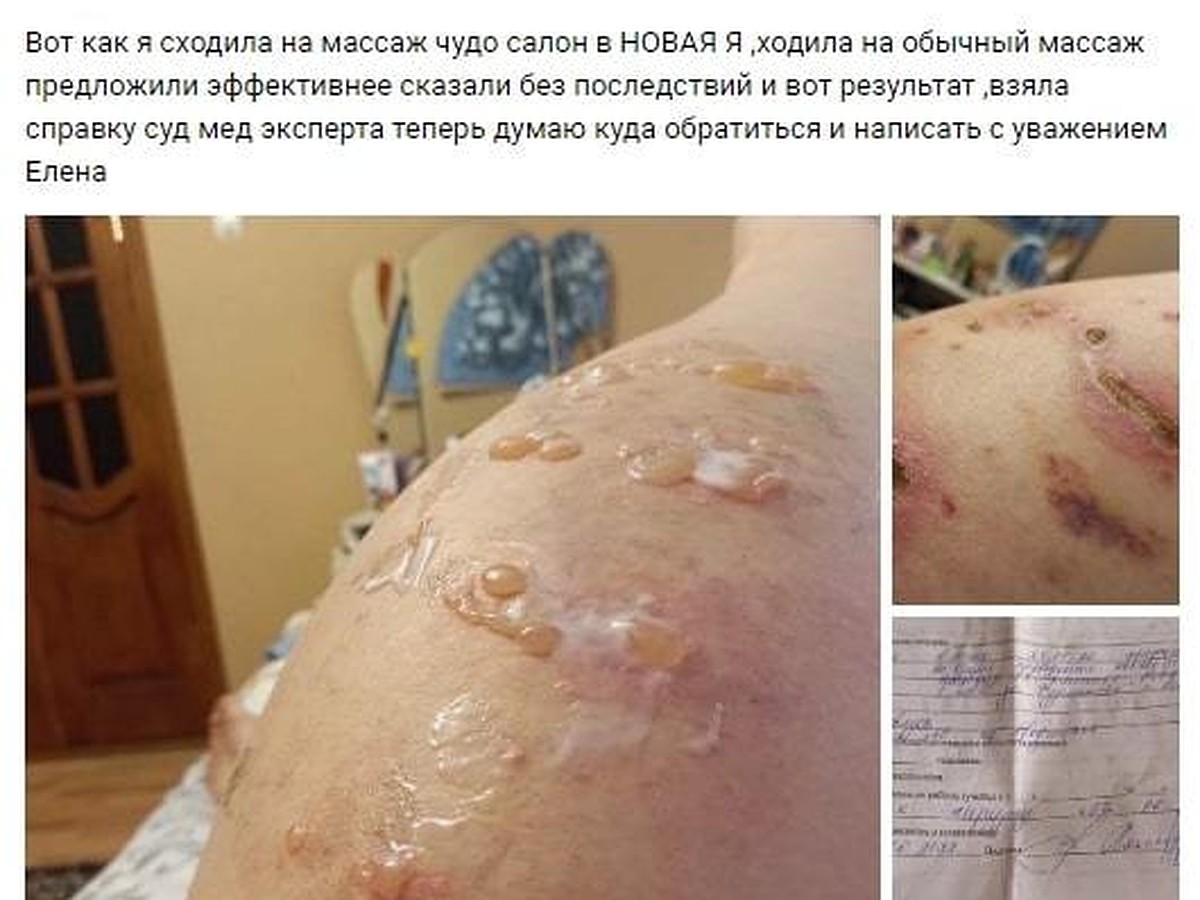 Женщина из Воронежской области показала ужасные раны после визита в  косметический салон - KP.RU