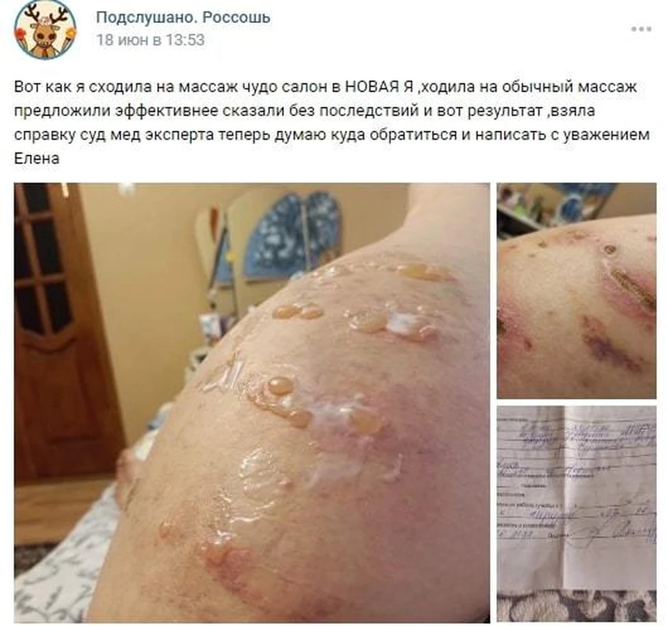 Женщина из Воронежской области показала ужасные раны после визита в  косметический салон - KP.RU