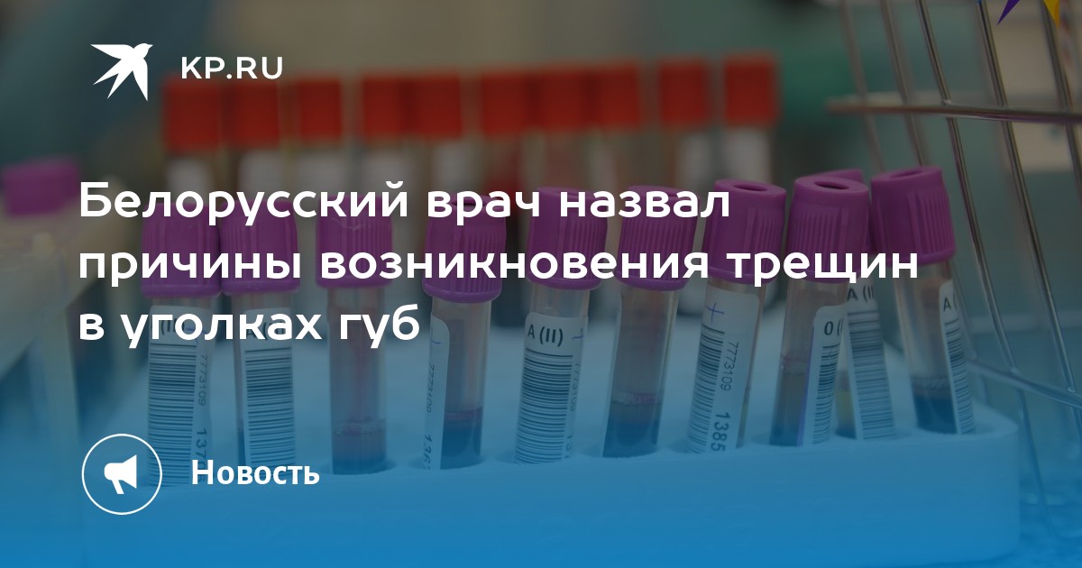 Белорусский врач назвал причины возникновения трещин в уголках губ - KP.RU