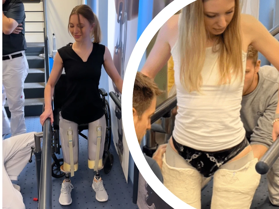Марчела Палади сейчас в Германии учится ходить на протезах. Фото: Соцсети.