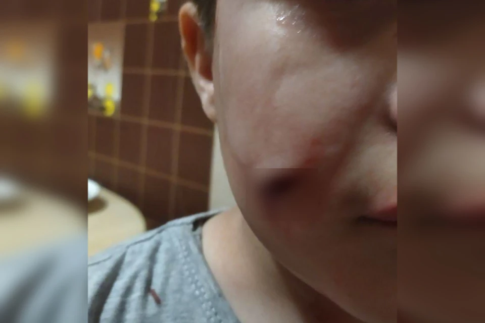 Ребенок бежал к отцу и в слезах кричал: «Меня укусила собака»