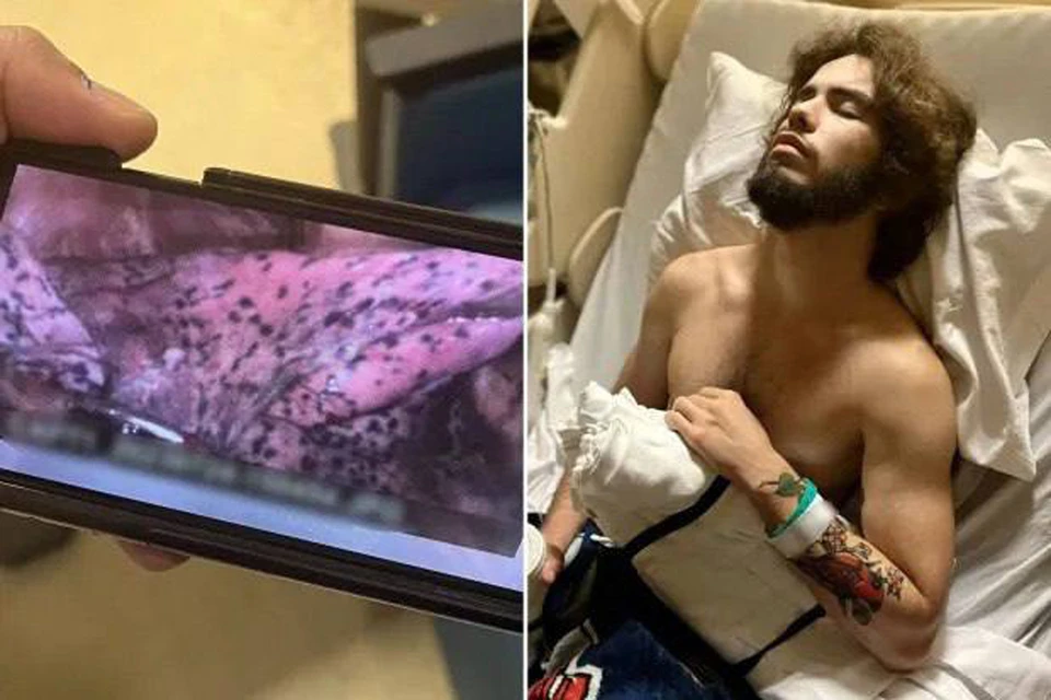 Теперь Шон обвиняет во всем вейпы