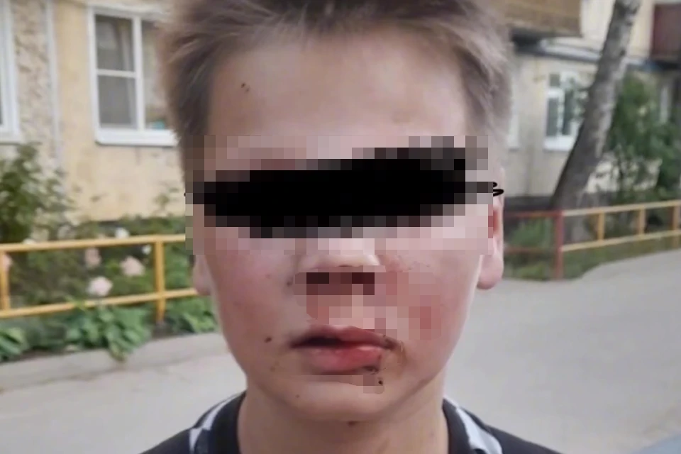 Неизвестные избили двоих школьников средь бела дня в Великом Новгороде. Фото: vk.com/club215921691