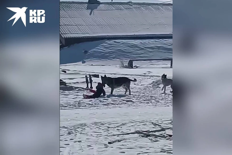 СК завел дело после нападения собаки в деревне Ширяева в Иркутском районе.