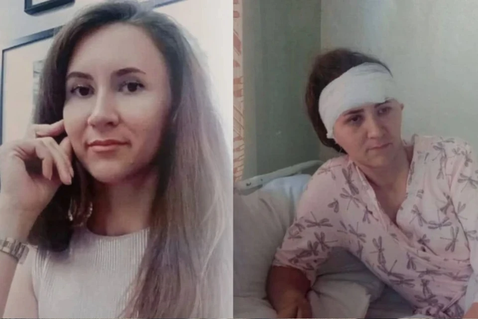 Женщина два года лечила последствия травмы, остался неизгладимый шрам (справа). Фото: Предоставлены потерпевшей