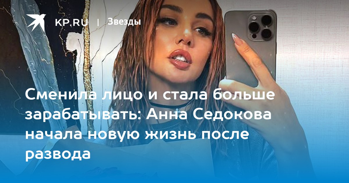 Сменила лицо и стала больше зарабатывать: Анна Седокова начала новую жизнь после развода