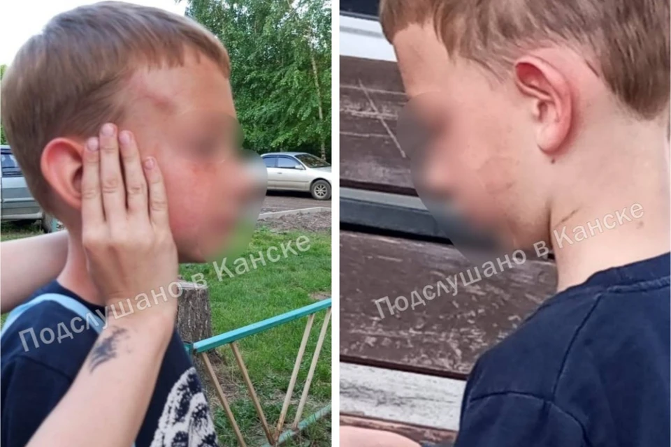 После того, как соседи избитого мальчика выложили шокирующие фотографии в соцсетях, полиция начала проверку. Фото: vk.com/p_v_k_kansk