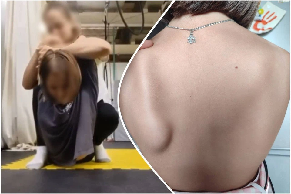 После тренировки врачи нашли у девочки разрыв сухожилия. Фото: "Черно-Белое Магнитогорск", vk.com/magnitkacity