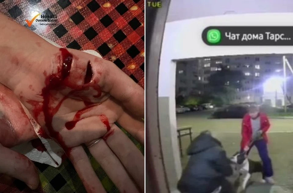 Девушке предстоит серьезная реабилитация, фото: скриншот видео из телеграм-канала «Новый омский форум»