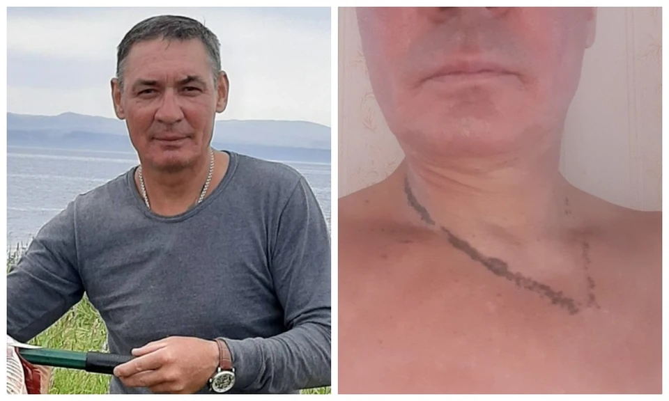 Как живет сибиряк, которого при ударе молнией спас нательный крестик. Фото: личный архив героя публикации.