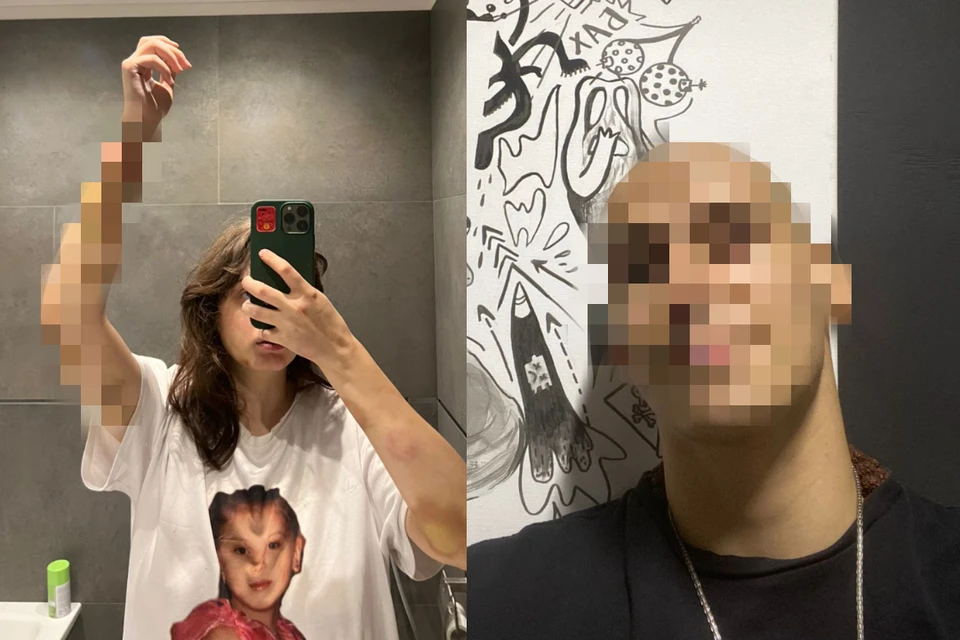 Валерия пожаловалась на истязания и преследования со стороны бывшего парня. Фото: Предоставлено потерпевшей