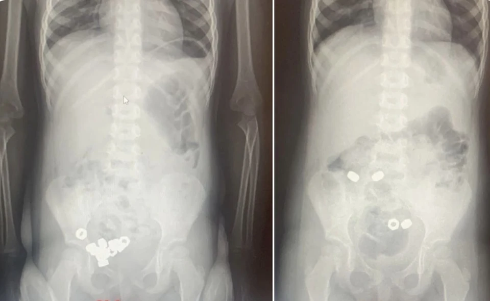 Рентген, фото ОДКБ №2