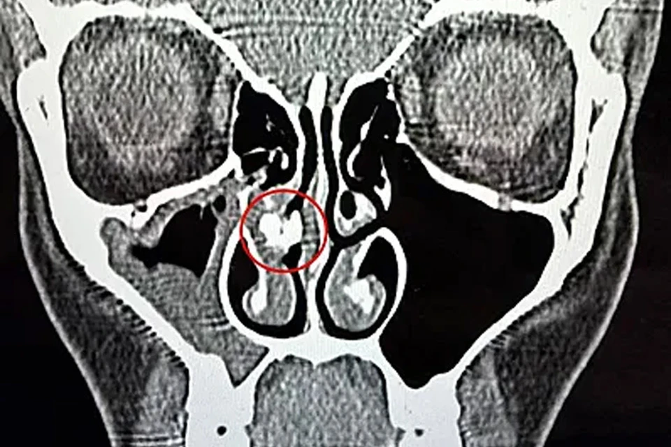 Источник: Jam Press/@candelanutri