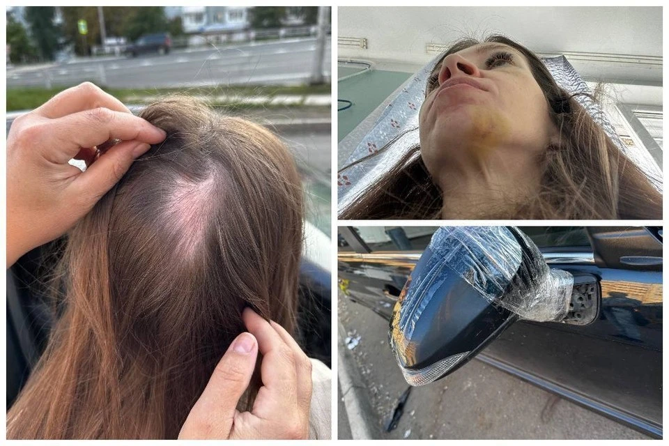 Сибирячку жестоко избила компания нетрезвых пассажиров, а, кроме того, разбили и автомобиль. Фото: архив героев публикации