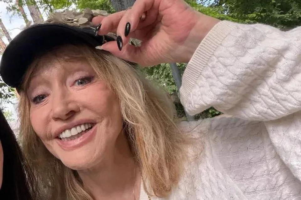 Алла Пугачева показала странное пятно на руке