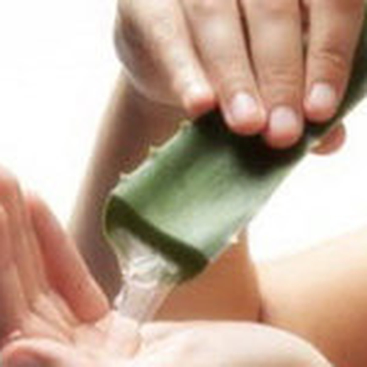 Гель алоэ от ожогов. Алоэ лекарственное растение. Aloe vera. Сок алоэ при онкологии. Стеблевой черенок алоэ.