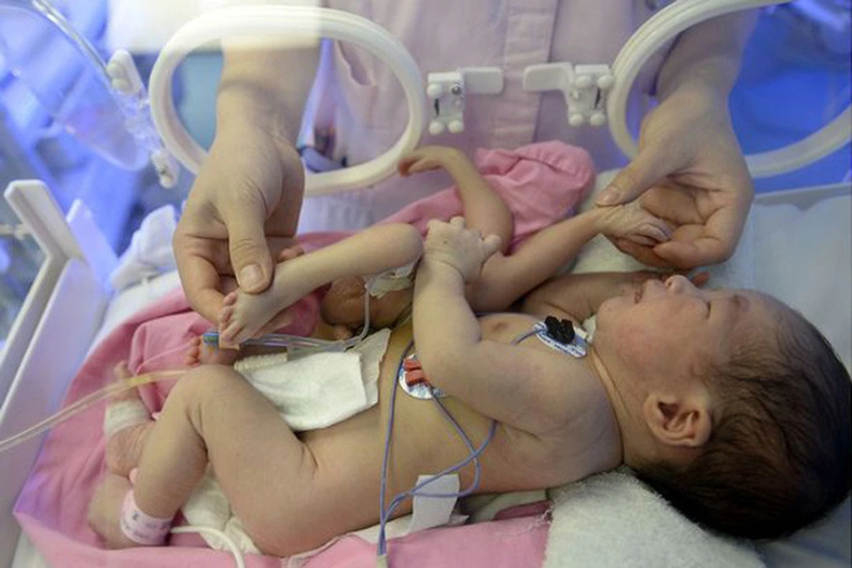В Медицинском центре женского и детского здоровья в Гуанджоу прооперировали малыша-паучка