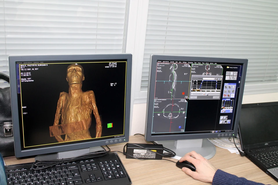 Алтайские мумии впервые обследовали томографом в Эрмитаже