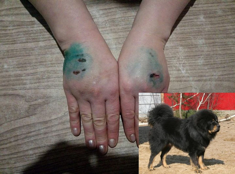 Слева: результат встречи с собакой. Справа: так выглядит тибетский мастиф. Фото: личный архив героя публикации и violetdog.ru