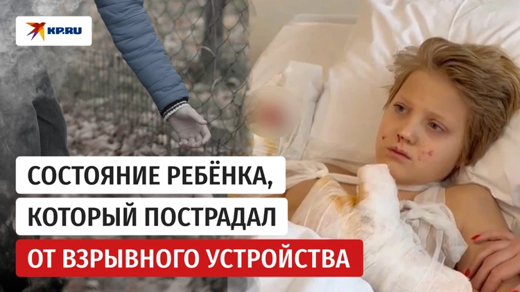«Не удалось сохранить 4 пальца на правой кисти»: состояние ребёнка, который пострадал от взрывного устройства