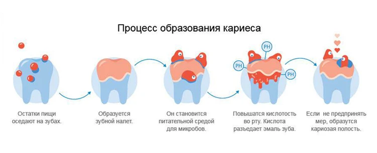 Чистить зубы вредно: правда или вымысел?