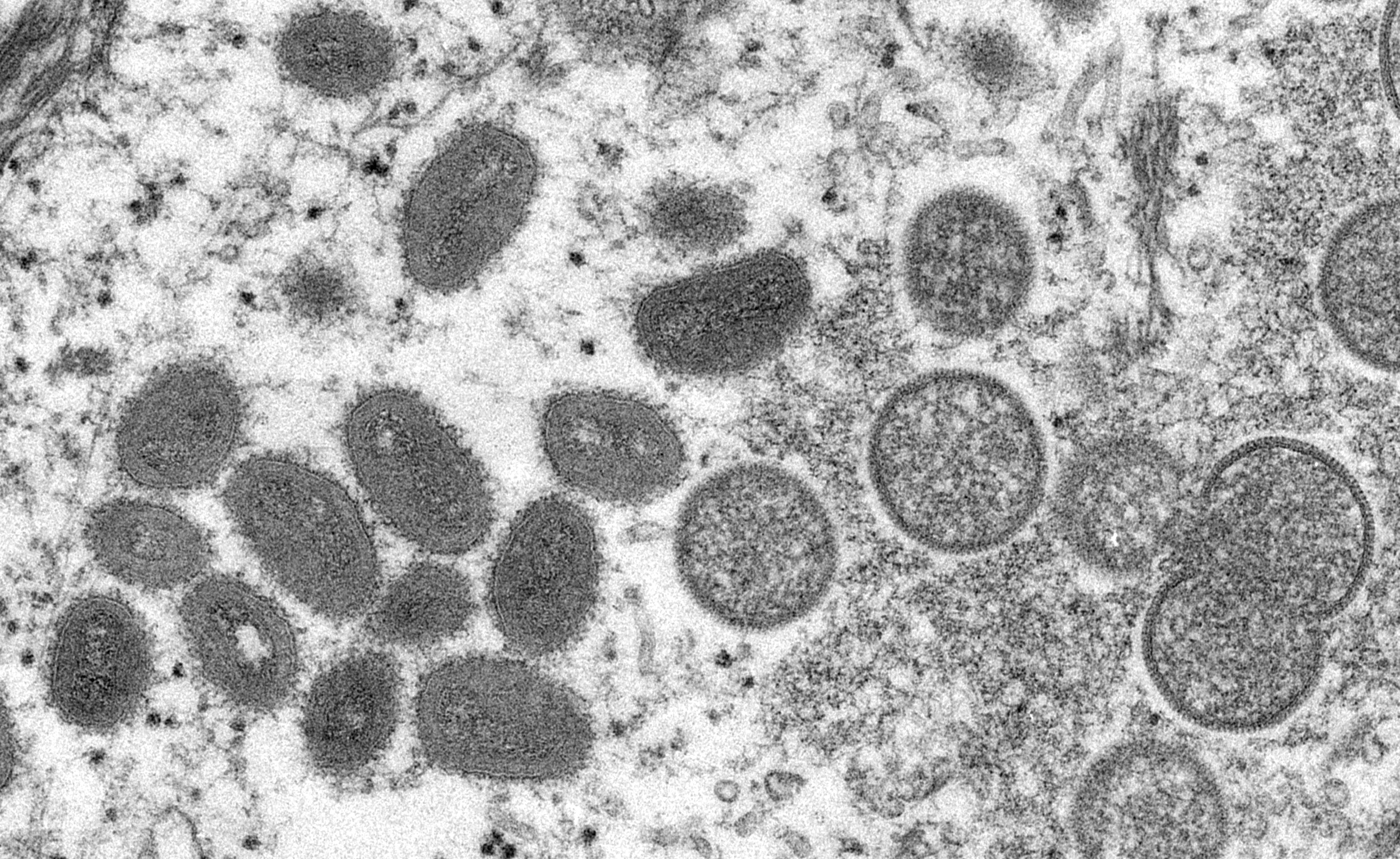 Virus opičích neštovic pod mikroskopem.