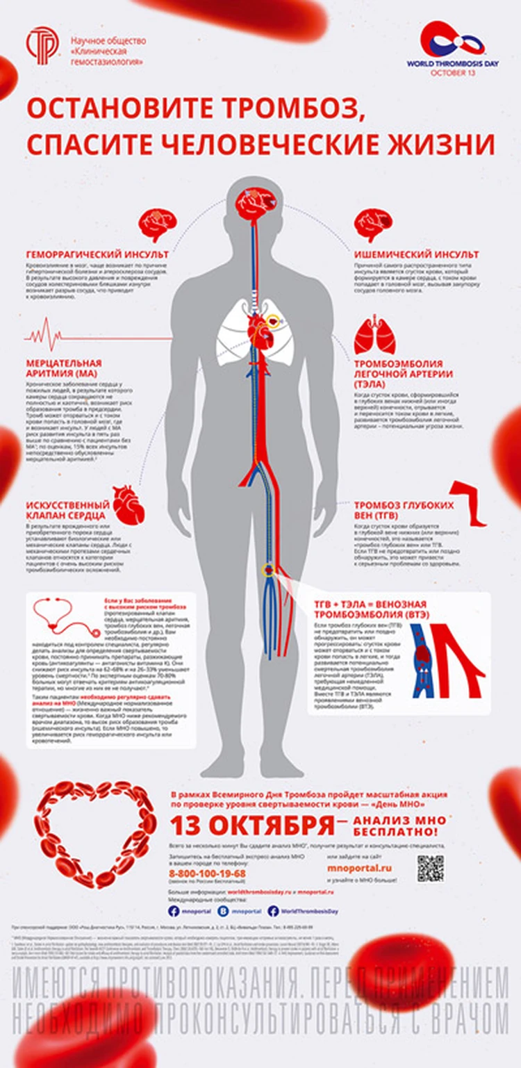 Во Всемирный день тромбоза россияне смогут бесплатно проверить  свертываемость крови - KP.RU